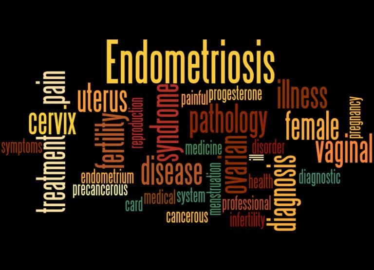words that start with endo